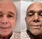 
                  Cantor Netinho volta ao hospital e detalha transplante de medula
