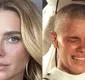 
                  Carolina Dieckmann surpreende com revelação sobre fase careca: 'Boba'