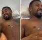 
                  Davi Brito mostra a barriga após Lipo HD: 'Me sentindo Léo Santana'