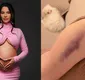 
                  Grávida, Raissa Barbosa desabafa de quadro de saúde após acidente
