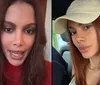Anitta fala pela 1ª vez após plástica e rebate ataques