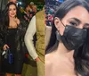 Bruna Biancardi assusta ao revelar infecção no rosto