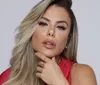 Esposa de Leonardo aparece com olho inchado e revela o que aconteceu