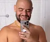Gominho posta foto nu após perder 61 kg e manda recado