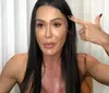 Gracyanne Barbosa mostra machucado após assalto: 'Lateral da cabeça'