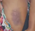 Mulher é espancada pelo ex-companheiro em Caraíva