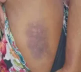 Mulher é espancada pelo ex-companheiro em Caraíva