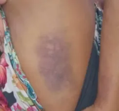 Mulher é espancada pelo ex-companheiro em Caraíva