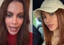 Anitta fala pela 1ª vez após plástica e rebate ataques