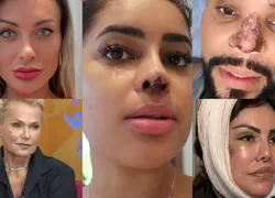 As celebridades que quase morreram após procedimentos estéticos