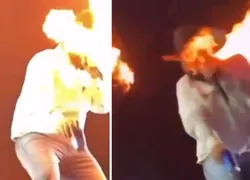 Cantor Léo fica ferido após ter rosto atingido por fogo em show; VÍDEO