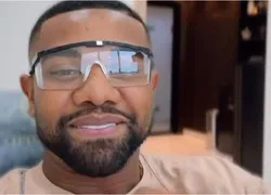 Davi Brito exibe antes e depois de procedimento nos dentes