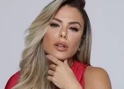 Esposa de Leonardo aparece com olho inchado e revela o que aconteceu