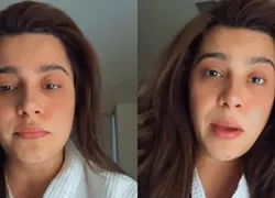 Lauana Prado teve que ser medicada após porta de avião soltar no ar