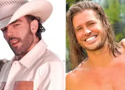 Luan Pereira surge com rosto ferido após briga com Dado Dolabella