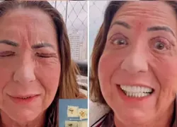 Mãe de Virginia aparece irreconhecível após cirurgia nos olhos