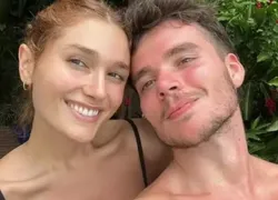 Marido de Sasha Meneghel passa por cirurgia plástica; saiba detalhes