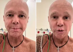 Netinho revela nova etapa contra o câncer: '128 injeções na barriga'