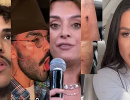 'Dança dos Famosos' tem machucados, briga e mais; veja zicas da edição