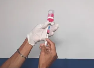 Cão é diagnosticado com raiva em Salvador após 20 anos sem registro