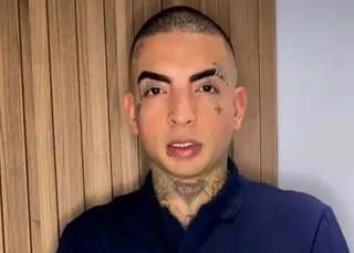 MC Guimê vira piada com resultado de harmonização: 'Mesma coisa'