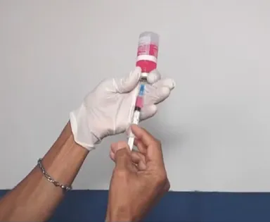 Cão é diagnosticado com raiva em Salvador após 20 anos sem registro