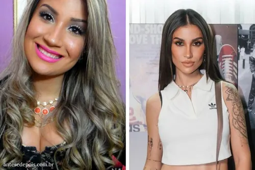 
					Além de Anitta: famosos que mudaram de rosto e estão irreconhecíveis
				
				