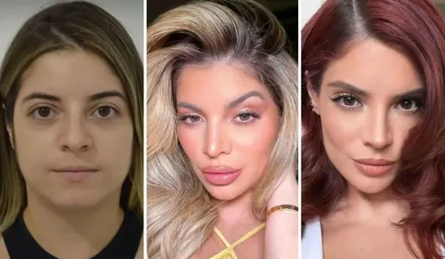 
					Além de Anitta: famosos que mudaram de rosto e estão irreconhecíveis
				
				