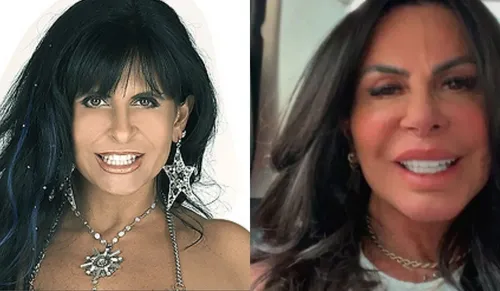 
					Além de Anitta: famosos que mudaram de rosto e estão irreconhecíveis
				
				