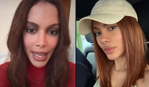 
					Anitta fala pela 1ª vez após plástica e rebate ataques
				
				