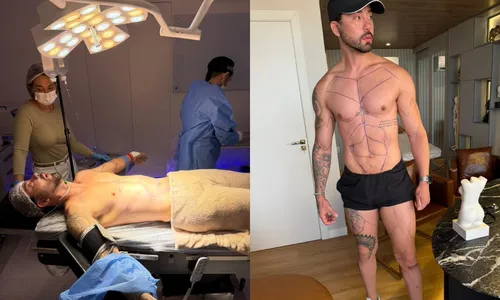 
					Rico Melquiades rebate críticas por cirurgia íntima: ‘O t*ba é meu'
				
				