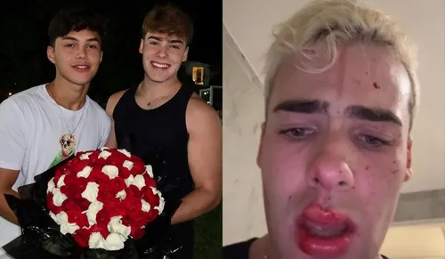   					Caio Cerqueira surge ensanguentado após briga com Luan Alencar; VÍDEO  				  				