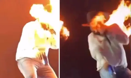 
				
					Cantor Léo mostra rosto após ser atingido por fogo em show
				
				