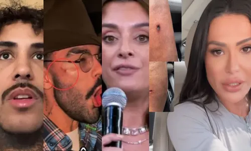 
					'Dança dos Famosos' tem machucados, briga e mais; veja zicas da edição
				
				