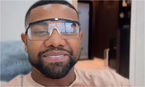   					Davi Brito exibe antes e depois de procedimento nos dentes  				  				