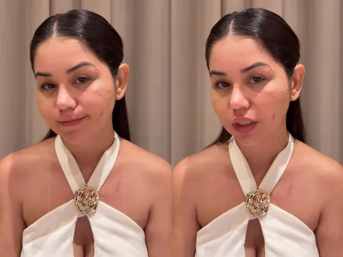 
					Ex de Diego, da dupla com Victor Hugo, justifica agressão à atual dele
				
				