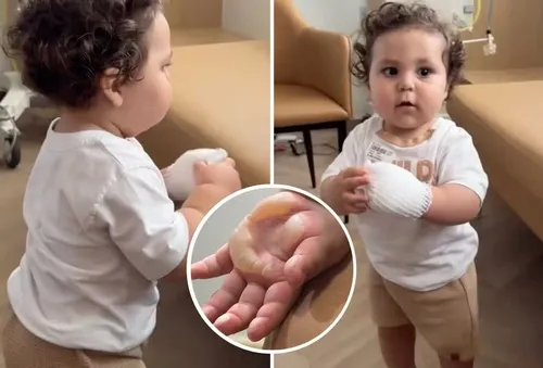 
					Filho de Viih Tube volta ao hospital após queimadura: 'Doloroso'
				
				