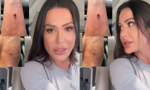 
					'Dança dos Famosos' tem machucados, briga e mais; veja zicas da edição
				
				