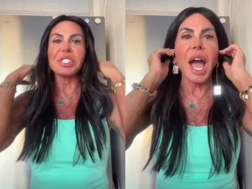 
					Gretchen reverte harmonização facial e emagrece 10 kg; antes e depois
				
				