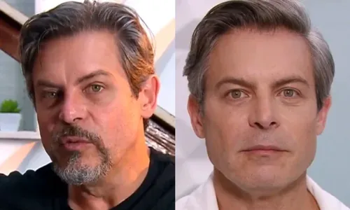 
					Luigi Baricelli surpreende com harmonização facial; antes e depois
				
				