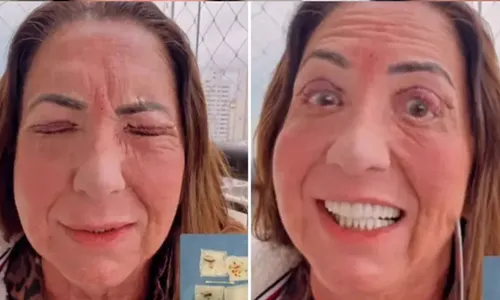 
					Mãe de Virginia aparece irreconhecível após cirurgia nos olhos
				
				