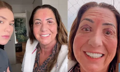 
					Mãe de Virginia aparece irreconhecível após cirurgia nos olhos
				
				