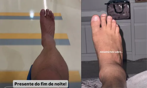 
					Marido de Simone Mendes é hospitalizado no mesmo dia que a cantora
				
				