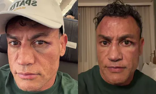 
					Popó desabafa após briga generalizada em luta: ‘Tomei três cabeçadas’
				
				