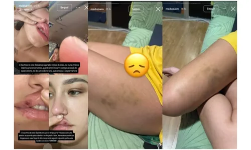 
					Quem é MC Estudante, acusado de agressões e violência por ex-namoradas
				
				