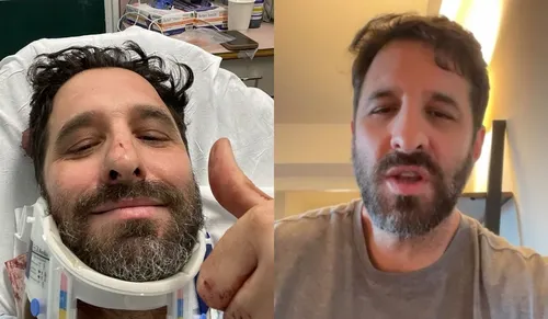 
					Rafinha Bastos se pronuncia após acidente: 'Apaguei no meio da rua'
				
				