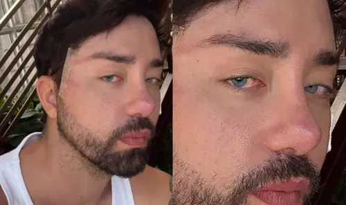 
					Rico Melquiades é desmascarado após aparecer com olhos azuis
				
				