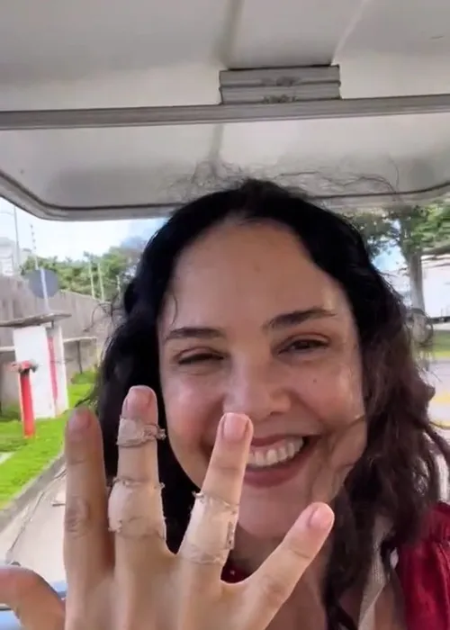 
					Dança dos Famosos: participante aparece machucada após ensaios
				
				