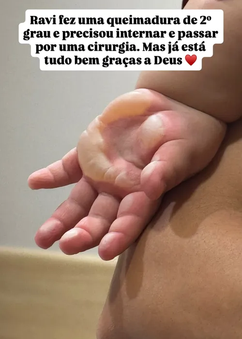 
					Filho de Viih Tube sofre queimadura e é internado às pressas; VÍDEOS
				
				