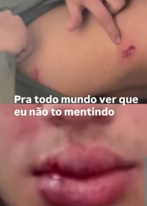 
					Quem é Luan Alencar, espancado ao descobrir traição de Caio Cerqueira
				
				